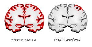 סוגי אפילפסיה - מוקדית וכללית